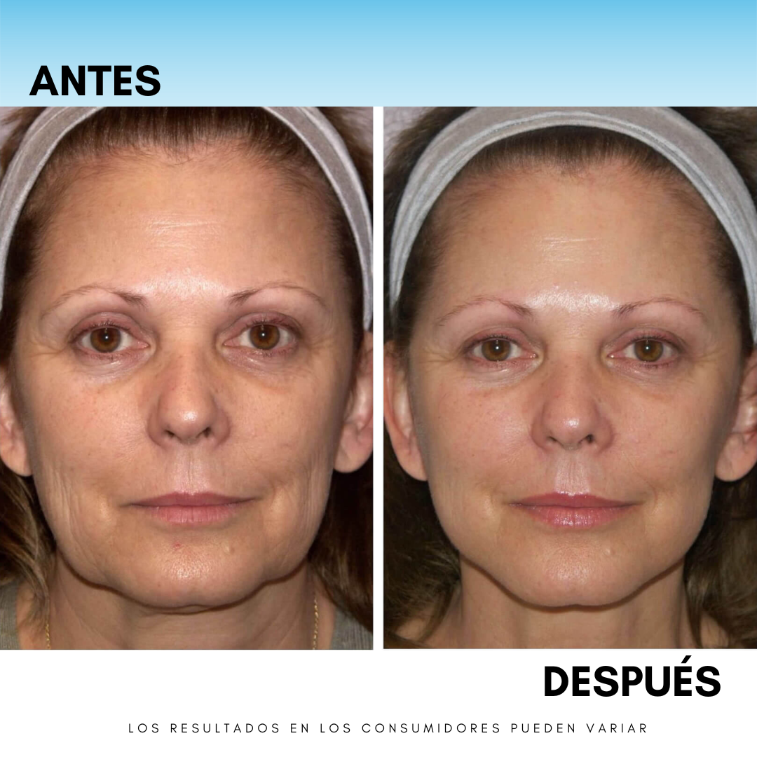 REGENERACIÓN DE PIEL Y ANTIENVEJECIMIENTO